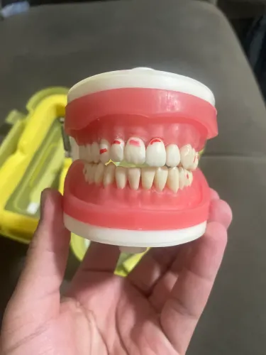 Manequim odontológico pronew (dentes com restauração)