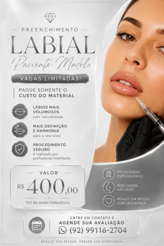 Preenchimento labial 
