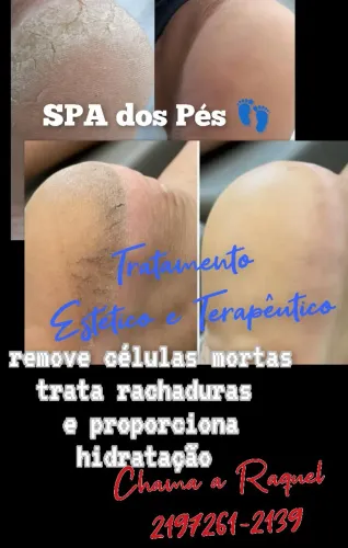 SPA dos Pés ? a domicílio 