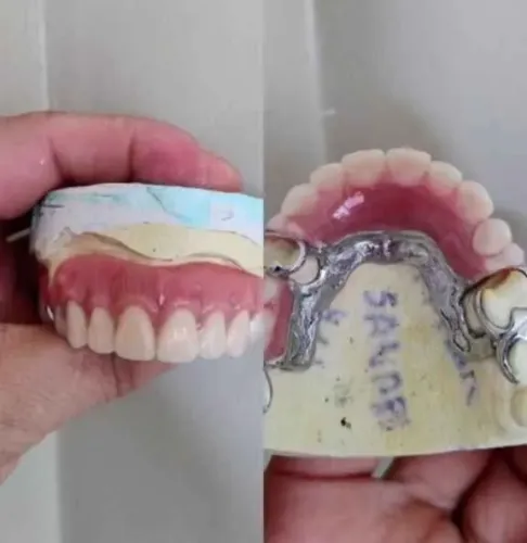 PRÓTESE DENTÁRIA Domicílio 