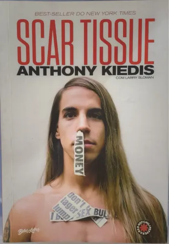 Scar Tissue